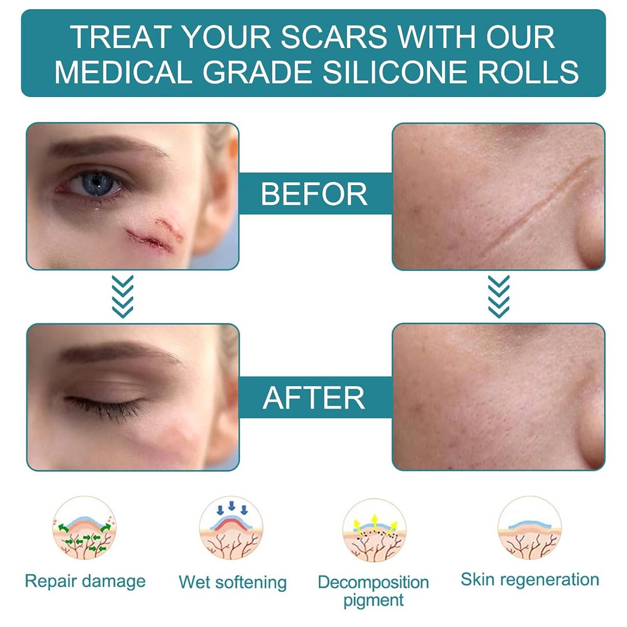 DermaFade™ Silicone Scar Sheets